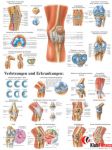 Anatomia człowieka STAW KOLANOWY CZŁOWIEKA poster 70x100cm